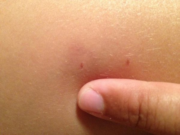 ქეცი, მუნი